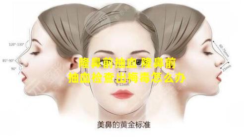 隆鼻前抽血 隆鼻前抽血检查出梅毒怎么办